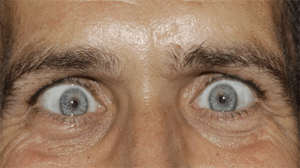 refranes-populares-sobre-los-locos