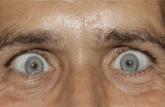 refranes-populares-sobre-los-locos