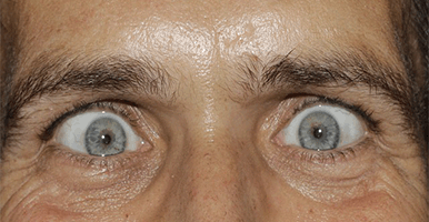 refranes-populares-sobre-los-locos